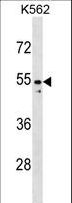 PAX2 Antibody - PAX2 Antibody western blot of K562 cell line lysates (35 ug/lane). The PAX2 antibody detected the PAX2 protein (arrow).