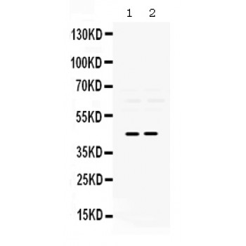 PAX2 Antibody - Pax2 antibody Western blot. All lanes: Anti Pax2 at 0.5 ug/ml. Lane 1: Rat Brain Tissue Lysate at 50 ug. Lane 2: Rat Lung Tissue Lysate at 50 ug. Predicted band size: 45 kD. Observed band size: 45 kD.