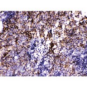 PAX2 Antibody - Pax2 antibody IHC-paraffin. IHC(P): Mouse Lymphadenoma Tissue.