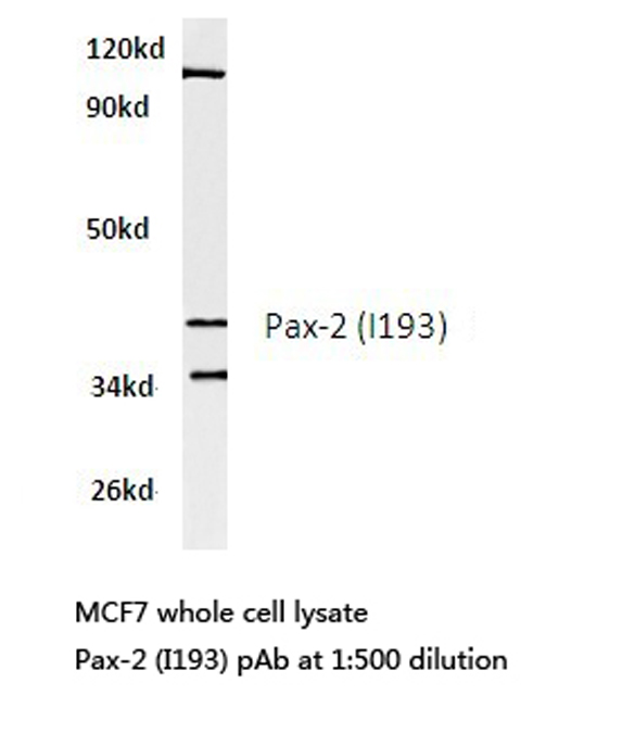 PAX2 Antibody - Western blot of Pax-2 (I193) pAb in extracts from MCF7 cells.