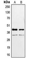 PAX2 Antibody - Western blot analysis of PAX2 expression in MCF7 (A); K562 (B) whole cell lysates.