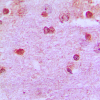 PAX2 Antibody - Immunohistochemical analysis of PAX2 staining in human brain formalin fixed paraffin embedded tissue section. The section was pre-treated using heat mediated antigen retrieval with sodium citrate buffer (pH 6.0). The section was then incubated with the antibody at room temperature and detected using an HRP conjugated compact polymer system. DAB was used as the chromogen. The section was then counterstained with hematoxylin and mounted with DPX.