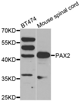 PAX2 Antibody - Western blot analysis of extracts of various cell lines, using PAX2 antibody.
