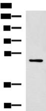 PAX2 Antibody - Western blot analysis of MCF-7 cell lysate  using PAX2 Polyclonal Antibody at dilution of 1:400