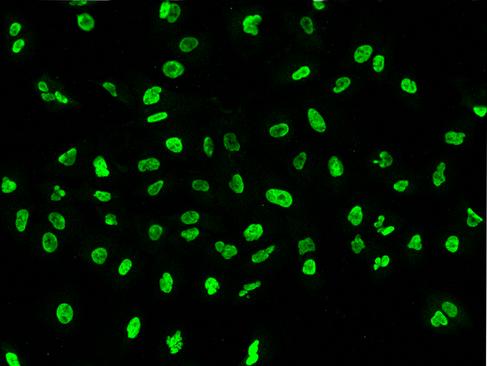 PAX2 Antibody - Immunofluorescence staining of PAX2 in A549 cells. Cells were fixed with 4% PFA, permeabilzed with 0.1% Triton X-100 in PBS, blocked with 10% serum, and incubated with rabbit anti-Human PAX2 polyclonal antibody (dilution ratio 1:200) at 4°C overnight. Then cells were stained with the Alexa Fluor 488-conjugated Goat Anti-rabbit IgG secondary antibody (green). Positive staining was localized to Nucleus.