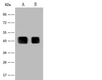 PAX2 Antibody - Anti-PAX2 rabbit polyclonal antibody at 1:500 dilution. Lane A: K562 Whole Cell Lysate. Lane B: 293T Whole Cell Lysate. Lysates/proteins at 30 ug per lane. Secondary: Goat Anti-Rabbit IgG (H+L)/HRP at 1/10000 dilution. Developed using the ECL technique. Performed under reducing conditions. Predicted band size: 44 kDa. Observed band size: 44 kDa.
