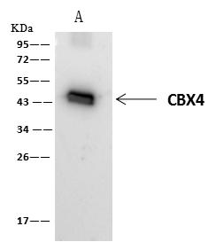 PAX2 Antibody - CBX4 was immunoprecipitated using: Lane A: 0.5 mg K562 Whole Cell Lysate. 4 uL anti-CBX4 rabbit polyclonal antibody and 60 ug of Immunomagnetic beads Protein A/G. Primary antibody: Anti-CBX4 rabbit polyclonal antibody, at 1:100 dilution. Secondary antibody: Clean-Blot IP Detection Reagent (HRP) at 1:1000 dilution. Developed using the ECL technique. Performed under reducing conditions. Predicted band size: 44 kDa. Observed band size: 45 kDa.