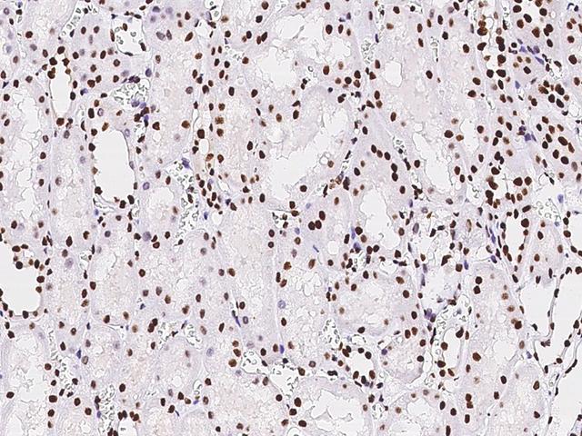 PAX2 Antibody - Immunochemical staining of human PAX2 in human kidney with rabbit polyclonal antibody at 1:1000 dilution, formalin-fixed paraffin embedded sections.