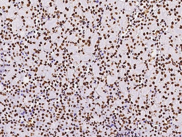 PAX2 Antibody - Immunochemical staining of human PAX2 in mouse kidney with rabbit polyclonal antibody at 1:1000 dilution, formalin-fixed paraffin embedded sections.