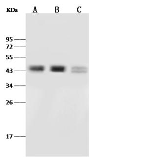 PAX2 Antibody - Anti-PAX2 rabbit polyclonal antibody at 1:500 dilution. Lane A: K562 Whole Cell Lysate. Lane B: 293T Whole Cell Lysate. Lane C: MCF7 Whole Cell Lysate. Lysates/proteins at 30 ug per lane. Secondary: Goat Anti-Rabbit IgG (H+L)/HRP at 1/10000 dilution. Developed using the ECL technique. Performed under reducing conditions. Predicted band size: 44 kDa. Observed band size: 44 kDa.