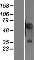 PAX2 Protein - Western validation with an anti-DDK antibody * L: Control HEK293 lysate R: Over-expression lysate