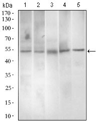 PAX3 Antibody - Western blot using PAX3 mouse monoclonal antibody against A549 (1), A431 (2), Jurkat (3), Rat spleen (4) and Mouse liver (5) cell lysate.