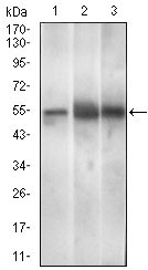 PAX3 Antibody - Western blot using PAX3 mouse monoclonal antibody against Mouse brain (1), Rat spleen (2), Mouse liver (3) cell lysate.