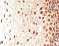 PAX3 Antibody - PAX3 antibody (3 ug/ml) staining of paraffin embedded Human Esophagus. Microwaved antigen retrieval with Tris/EDTA buffer pH9, HRP-staining.