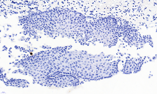 PAX3 Antibody - Negative Control showing staining of paraffin embedded Human Esophagus, with no primary antibody.
