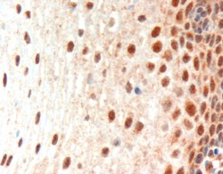 PAX3 Antibody - PAX3 antibody (3µg/ml) staining of paraffin embedded Human Oesophagus. Microwaved antigen retrieval with Tris/EDTA buffer pH9, HRP-staining. Data obtained using previous batch.