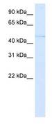 PAX3 Antibody - Western blot of fetal lung lysate using PAX3 Antibody at 0.25 ug/ml. This image was taken for the unconjugated form of this product. Other forms have not been tested.