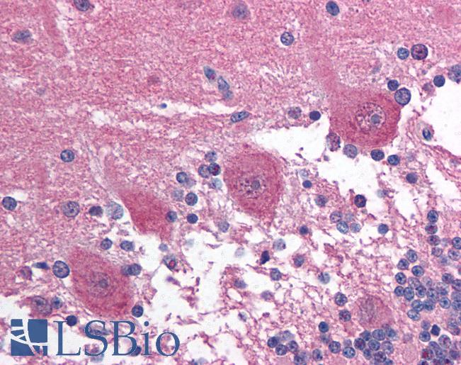 PAX3 Antibody - Anti-PAX3 antibody IHC of human brain, cerebellum. Immunohistochemistry of formalin-fixed, paraffin-embedded tissue after heat-induced antigen retrieval. Antibody concentration 5 ug/ml.  This image was taken for the unconjugated form of this product. Other forms have not been tested.