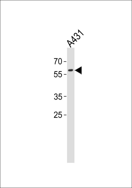 PAX3 Antibody - PAX3 Antibody western blot of A431 cell line lysates (35 ug/lane). The PAX3 antibody detected the PAX3 protein (arrow).