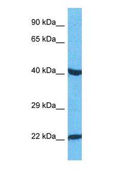PAX3 Antibody - Western blot of PAX3 Antibody with human HepG2 Whole Cell lysate.  This image was taken for the unconjugated form of this product. Other forms have not been tested.