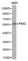 PAX3 Antibody - Western blot of extracts of A431 cell lines, using PAX3 antibody.