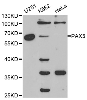 PAX3 Antibody - Western blot analysis of extracts of various cell lines, using PAX3 antibody at 1:1000 dilution. The secondary antibody used was an HRP Goat Anti-Rabbit IgG (H+L) at 1:10000 dilution. Lysates were loaded 25ug per lane and 3% nonfat dry milk in TBST was used for blocking.