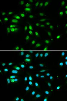 PAX3 Antibody - Immunofluorescence analysis of MCF-7 cells using PAX3 antibody. Blue: DAPI for nuclear staining.