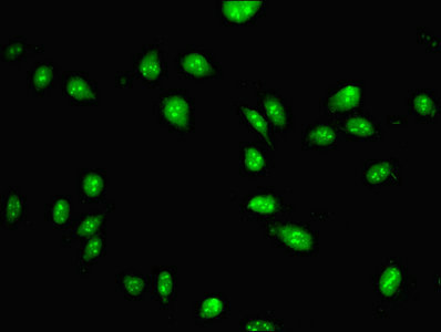 PAX3 Antibody - Immunofluorescent analysis of Hela cells using PAX3 Antibody at dilution of 1:100 and Alexa Fluor 488-congugated AffiniPure Goat Anti-Rabbit IgG(H+L)