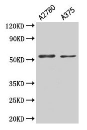 PAX3 Antibody - Western Blot Positive WB detected in: A2780 whole cell lysate All lanes: PAX3 antibody at 5.3µg/ml Secondary Goat polyclonal to rabbit IgG at 1/50000 dilution Predicted band size: 53, 25, 23, 45, 46, 54, 56 kDa Observed band size: 53 kDa
