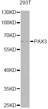 PAX3 Antibody - Western blot analysis of extracts of 293T cells, using PAX3 antibody at 1:1000 dilution. The secondary antibody used was an HRP Goat Anti-Rabbit IgG (H+L) at 1:10000 dilution. Lysates were loaded 25ug per lane and 3% nonfat dry milk in TBST was used for blocking. An ECL Kit was used for detection and the exposure time was 30s.