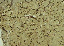 PAX3 Antibody - 1:100 staining mouse brain tissue by IHC-P. The sample was formaldehyde fixed and a heat mediated antigen retrieval step in citrate buffer was performed. The sample was then blocked and incubated with the antibody for 1.5 hours at 22°C. An HRP conjugated goat anti-rabbit antibody was used as the secondary.