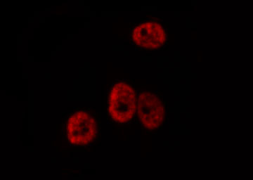 PAX3 Antibody - Staining HepG2 cells by IF/ICC. The samples were fixed with PFA and permeabilized in 0.1% Triton X-100, then blocked in 10% serum for 45 min at 25°C. The primary antibody was diluted at 1:200 and incubated with the sample for 1 hour at 37°C. An Alexa Fluor 594 conjugated goat anti-rabbit IgG (H+L) antibody, diluted at 1/600, was used as secondary antibody.
