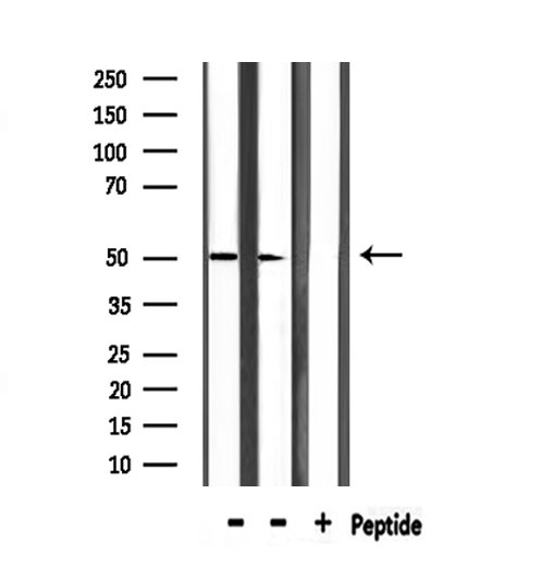 PAX3 Antibody - Western blot analysis of extracts of mouse liver, rat muscle using PAX3 antibody.