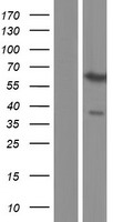 PAX3 Protein - Western validation with an anti-DDK antibody * L: Control HEK293 lysate R: Over-expression lysate