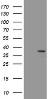 PAX4 Antibody - HEK293T cells were transfected with the pCMV6-ENTRY control (Left lane) or pCMV6-ENTRY PAX4 (Right lane) cDNA for 48 hrs and lysed. Equivalent amounts of cell lysates (5 ug per lane) were separated by SDS-PAGE and immunoblotted with anti-PAX4.