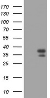 PAX4 Antibody - HEK293T cells were transfected with the pCMV6-ENTRY control (Left lane) or pCMV6-ENTRY PAX4 (Right lane) cDNA for 48 hrs and lysed. Equivalent amounts of cell lysates (5 ug per lane) were separated by SDS-PAGE and immunoblotted with anti-PAX4.