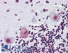 PAX4 Antibody - Anti-PAX4 antibody IHC of human brain, cerebellum. Immunohistochemistry of formalin-fixed, paraffin-embedded tissue after heat-induced antigen retrieval. Antibody concentration 5 ug/ml.  This image was taken for the unconjugated form of this product. Other forms have not been tested.