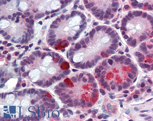 PAX4 Antibody - Small intestine: Formalin-Fixed, Paraffin-Embedded (FFPE).  This image was taken for the unconjugated form of this product. Other forms have not been tested.