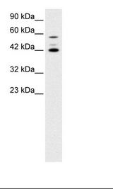 PAX4 Antibody - Jurkat Cell Lysate.  This image was taken for the unconjugated form of this product. Other forms have not been tested.