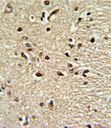 PAX4 Antibody - Formalin-fixed and paraffin-embedded human brain tissue reacted with PAX4 Antibody , which was peroxidase-conjugated to the secondary antibody, followed by DAB staining. This data demonstrates the use of this antibody for immunohistochemistry; clinical relevance has not been evaluated.