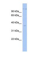 PAX4 Antibody - PAX4 antibody Western blot of Fetal Stomach lysate. This image was taken for the unconjugated form of this product. Other forms have not been tested.