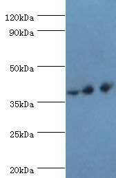 PAX4 Antibody - Western blot. All lanes: Paired box protein Pax-4 antibody at 6 ug/ml. Lane 1: HeLa whole cell lysate. Lane 2: K562 whole cell lysate. Lane 3: mouse pancreas. secondary Goat polyclonal to rabbit at 1:10000 dilution. Predicted band size: 38 kDa. Observed band size: 38 kDa.