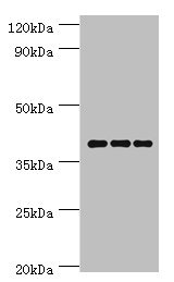 PAX4 Antibody - Western blot All lanes: Paired box protein Pax-4 antibody at 6µg/ml Lane 1: Hela whole cell lysate Lane 2: K562 whole cell lysate Lane 3: Mouse pancreatic Secondary Goat polyclonal to rabbit IgG at 1/10000 dilution Predicted band size: 38, 30 kDa Observed band size: 38 kDa