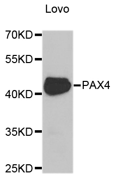 PAX4 Antibody - Western blot analysis of extracts of Lovo cell lines.