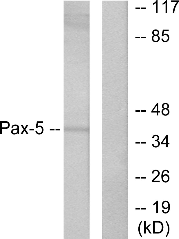 PAX5 Antibody - Western blot analysis of lysates from 293 cells, using Pax-5 Antibody. The lane on the right is blocked with the synthesized peptide.
