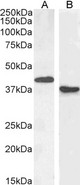 PAX5 Antibody - PAX5 / BSAP antibody (1µg/ml) staining of Mouse (A) and (0.3ug/ml) Rat (B) Spleen lysate (35µg protein in RIPA buffer). Primary incubation was 1 hour. Detected by chemiluminescence.