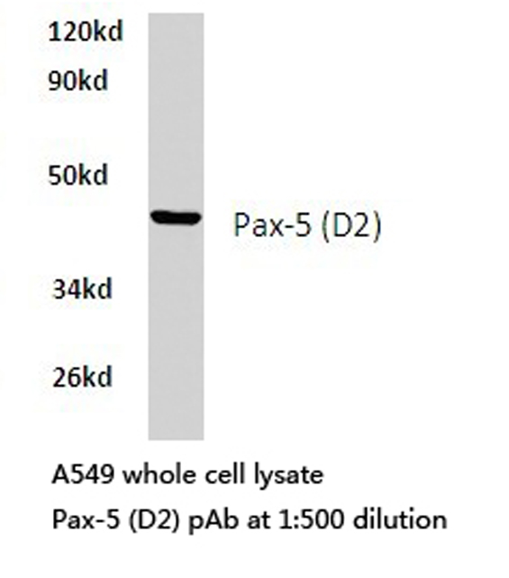PAX5 Antibody - Western blot of Pax-5 (D2) pAb in extracts from A549 cells.