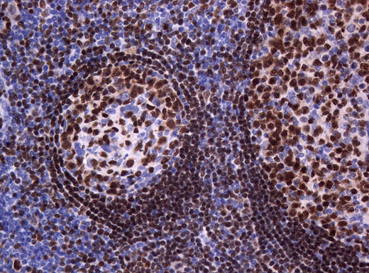 PAX5 Antibody - Immunohistochemical staining of paraffin-embedded Human tonsil within the normal limits using anti-PAX5 mouse monoclonal antibody. (Heat-induced epitope retrieval by 1mM EDTA in 10mM Tris buffer. (pH8.0) at 120°C for 3 min. (1:200)