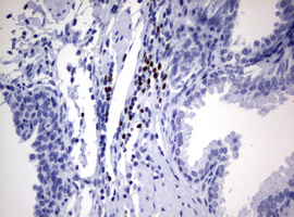 PAX5 Antibody - IHC of paraffin-embedded Human prostate tissue using anti-PAX5 mouse monoclonal antibody.