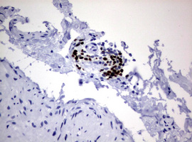 PAX5 Antibody - IHC of paraffin-embedded Human bladder tissue using anti-PAX5 mouse monoclonal antibody.